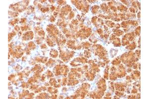 Formalin-fixed, paraffin-embedded human Pancreas stained with Clathrin, LC Monoclonal Antibody (CLC/1421). (CLTA/CLTB anticorps  (N-Term))