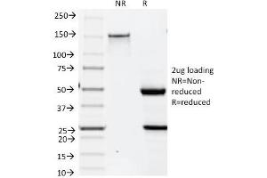 SDS-PAGE Analysis Purified Cytokeratin 19 Mouse Monoclonal Antibody (BA17).