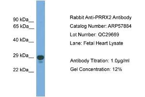 WB Suggested Anti-PRRX2  Antibody Titration: 0. (PRRX2 anticorps  (Middle Region))