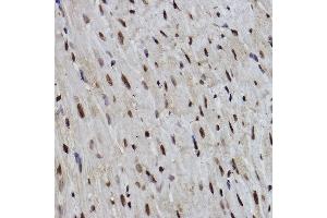 Immunohistochemistry of paraffin-embedded mouse heart using PDCD7 Rabbit mAb (ABIN3022039, ABIN3022040, ABIN3022041, ABIN1513274 and ABIN1514421) at dilution of 1:100 (40x lens). (PDCD7 anticorps)