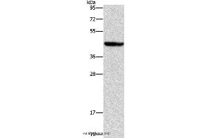 Western blot analysis of Mouse liver tissue, using ORM2 Polyclonal Antibody at dilution of 1:700
