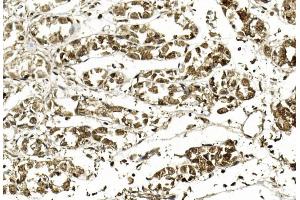 Immunohistochemical analysis of paraffin-embedded Human stomach section using Pink1 am8490b.