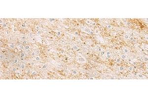 Immunohistochemistry of paraffin-embedded Human brain tissue using RHCG Polyclonal Antibody at dilution of 1:25(x200)
