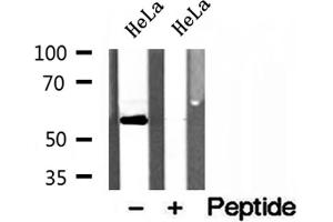 Western blot analysis of extracts of HeLa cells, using PDLIM7 antibody. (PDLIM7 anticorps  (N-Term))
