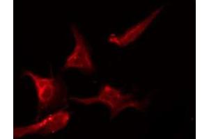 ABIN6275578 staining 293 by IF/ICC. (SCN2B anticorps  (Internal Region))