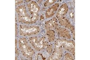 Immunohistochemical staining of human kidney with ZNF234 polyclonal antibody  shows distinct nuclear and moderate cytoplasmic positivity in cells in tubules at 1:50-1:200 dilution. (ZNF234 anticorps)