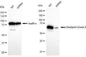Western blotting analysis using checkpoint kinase 2 antibody (ABIN7798040). (Recombinant CHEK2 anticorps)