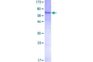 Image no. 1 for Serpin Family A Member 7 (SERPINA7) (AA 1-415) protein (GST tag) (ABIN1319602)