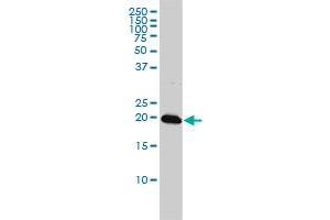 C22orf18 monoclonal antibody (M01), clone 4C12-2C8 Western Blot analysis of C22orf18 expression in K-562 . (CENPM anticorps  (AA 1-180))
