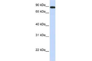 WB Suggested Anti-FAM47A Antibody Titration: 0. (FAM47A anticorps  (Middle Region))