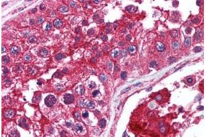 Human Testis (formalin-fixed, paraffin-embedded) stained with mTOR antibody ABIN214561 at 2.