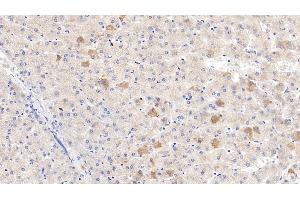 Detection of C4BPb in Human Liver Tissue using Polyclonal Antibody to C4 Binding Protein Beta (C4BPb)