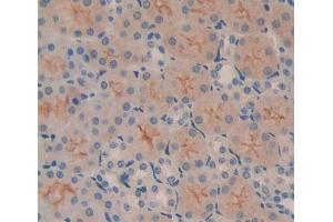 Used in DAB staining on fromalin fixed paraffin- embedded kidney tissue