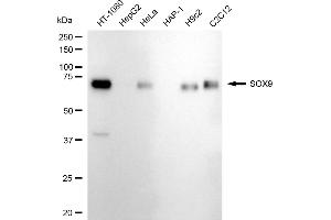Western blotting analysis using SOX9 antibody (ABIN7800973). (Recombinant SRY-Box Transcription Factor 9 anticorps)