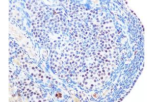 Immunohistochemistry of paraffin-embedded rat ovary using SUMO2/3 Rabbit mAb (ABIN7270370) at dilution of 1:100 (40x lens).