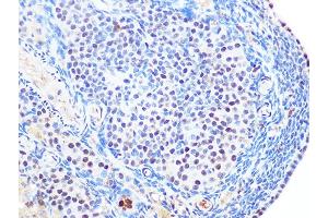 Immunohistochemistry of paraffin-embedded rat ovary using SUMO2/3 Rabbit mAb (ABIN7270370) at dilution of 1:100 (40x lens). (SUMO2 anticorps)