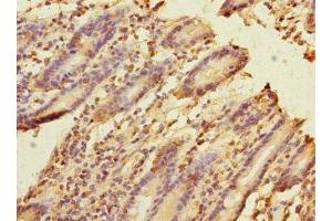 Immunohistochemistry of paraffin-embedded human duodenal tissue using ABIN7152685 at dilution of 1:100 (FRMD6 anticorps  (AA 413-622))