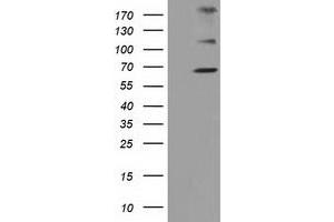 Western Blotting (WB) image for anti-Zinc Finger, Imprinted 2 (ZIM2) (AA 1-150), (AA 428-527) antibody (ABIN1490588) (ZIM2 anticorps  (AA 1-150, AA 428-527))