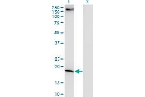 Western Blot analysis of FTL expression in transfected 293T cell line by FTL monoclonal antibody, clone 4C10.