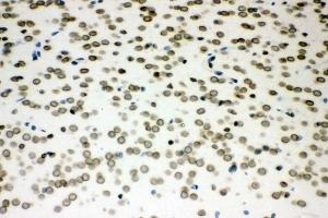 IHC analysis of Sumo 1/SUMO1 using anti-Sumo 1/SUMO1 antibody (ABIN7603002). (SUMO1 anticorps  (Middle Region))