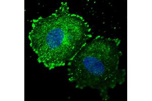 Fluorescent confocal image of MCF7 cells stained with phospho-ERBB2- antibody. (ErbB2/Her2 anticorps  (pTyr1005))