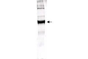 Figure 1. (GLUD1 anticorps)