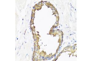 Immunohistochemistry of paraffin-embedded human prostate using SMAD2 antibody (ABIN5998884) at dilution of 1/100 (40x lens). (SMAD2 anticorps)