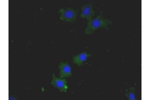 Detection of HMGB1 in Human HepG2 Cells using Monoclonal Antibody to High Mobility Group Protein 1 (HMGB1) (HMGB1 anticorps  (AA 1-215))