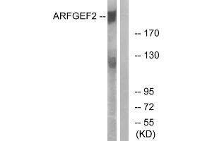 Western blot analysis of extracts from A549 cells, using ARFGEF2 antibody. (ARFGEF2 anticorps  (C-Term))