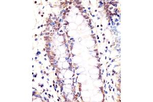 (ABIN6243725 and ABIN6578368) staining LSM2 in human colon tissue sections by Immunohistochemistry (IHC-P - paraformaldehyde-fixed, paraffin-embedded sections). (LSM2 anticorps  (AA 55-89))