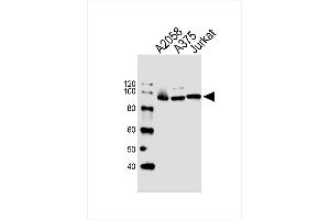 Lane 1: A2058, Lane 2: A375, Lane 3: Jurkat cell lysate at 20 µg per lane, probed with bsm-51428M MAGED1 (1305CT862. (MAGED1 anticorps)