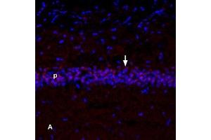 NGF localization in mouse hippocampus. (NGF 2.5S protein (Biotin))