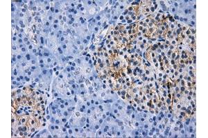 Immunohistochemical staining of paraffin-embedded liver tissue using anti-RPA2 mouse monoclonal antibody. (RPA2 anticorps)