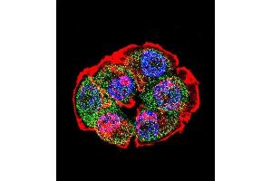 Confocal immunofluorescent analysis of CTNNB1 Antibody (C-term) with T47D cell followed by Alexa Fluor 488-conjugated goat anti-rabbit lgG (green).