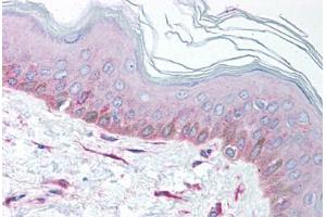 Human Skin (formalin-fixed, paraffin-embedded) stained with EEA1 antibody ABIN214099 at 5 ug/ml followed by biotinylated goat anti-rabbit IgG secondary antibody ABIN481713, alkaline phosphatase-streptavidin and chromogen.