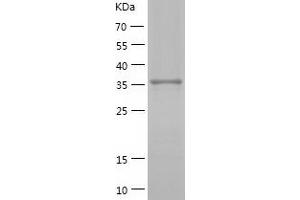 Western Blotting (WB) image for NCK Adaptor Protein 2 (NCK2) (AA 1-380) protein (His-IF2DI Tag) (ABIN7124118)