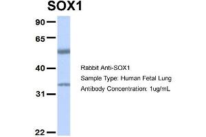 Host: Rabbit Target Name: SOX1 Sample Type: Human Fetal Lung Antibody Dilution: 1.