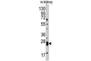 Western blot analysis of CLDN1 polyclonal antibody  in mouse kidney tissue lysate (35 ug/lane).