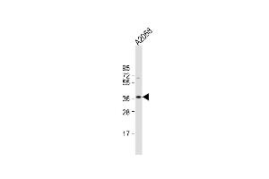 Anti-IgA Antibody (C-term) at 1:1000 dilution +  whole cell lysate Lysates/proteins at 20 μg per lane. (IGHA1 anticorps  (C-Term))