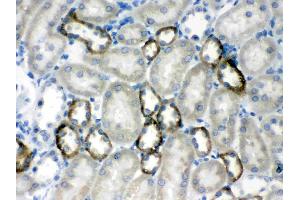 CASR was detected in paraffin-embedded sections of rat kidney tissues using rabbit anti- CASR Antigen Affinity purified polyclonal antibody (Catalog # ) at 1 µg/mL. (CASR anticorps  (AA 926-1078))