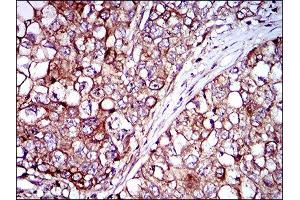Immunohistochemistry (IHC) image for anti-Zinc Finger Protein 42 (ZFP42) (AA 249-310) antibody (ABIN1846770) (ZFP42 anticorps  (AA 249-310))