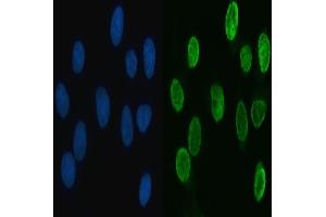 anti-Heterogeneous Nuclear Ribonucleoprotein L (HNRNPL) (AA 546-571), (C-Term) antibody