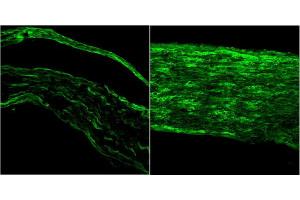 ABIN5539690 (1µg/ml) staining of PFA-perfused cryosection of Mouse sciatic nerve (left) and injured sciatic nerve (right). (BDNF anticorps  (Internal Region))