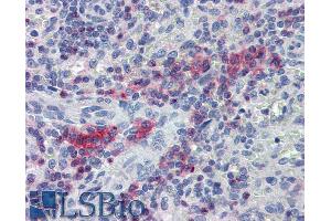Immunohistochemistry staining of human spleen (paraffin sections) with anti-LIME polyclonal antibody.