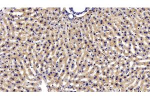 Detection of IDE in Mouse Liver Tissue using Polyclonal Antibody to Insulin Degrading Enzyme (IDE)