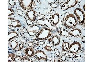 Immunohistochemical staining of paraffin-embedded Kidney tissue using anti-MTRF1L mouse monoclonal antibody. (MTRF1L anticorps)
