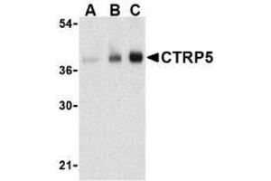 Western blot analysis of CTRP5 in human brain cell lysate with AP30254PU-N CTRP5 antibody at (A) 1, (B) 2, and (C) 4 μg/ml. (CTRP5 anticorps  (N-Term))