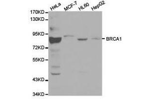 Western Blotting (WB) image for anti-Breast Cancer 1 (BRCA1) antibody (ABIN1871342)