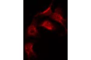 ABIN6267383 staining 293 by IF/ICC.