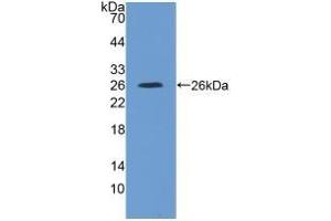 Detection of Recombinant IL4R, Rat using Polyclonal Antibody to Interleukin 4 Receptor (IL4R) (IL4 Receptor anticorps  (AA 26-232))